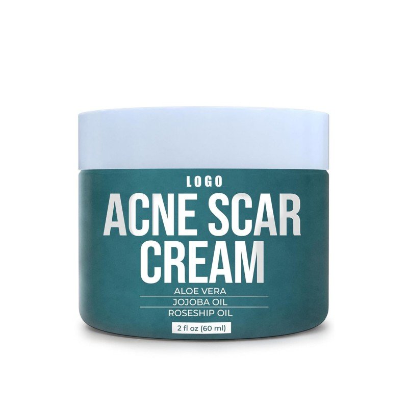 acne scars removal cream