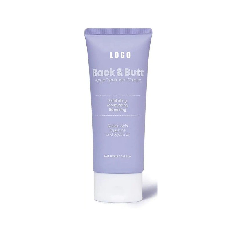 acne treatment cream