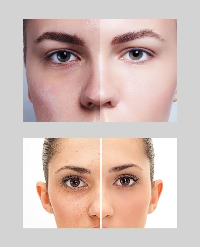 Skin Nourishment Before After