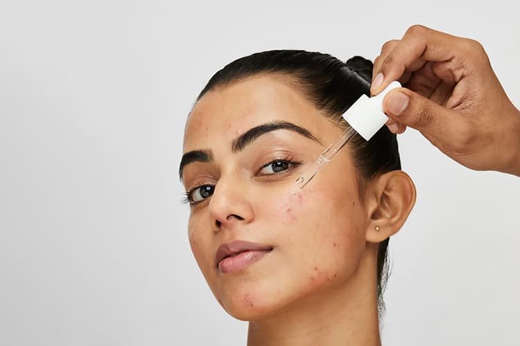 Acne & Blemish Control