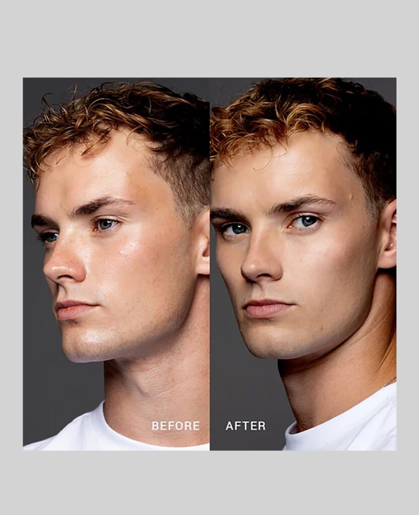 oil control before after
