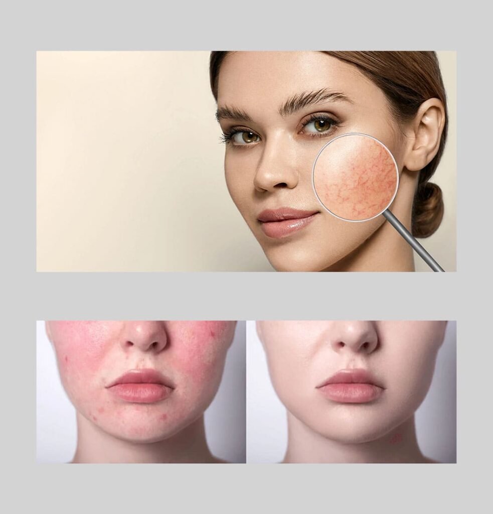 Sensitive Skin care before after