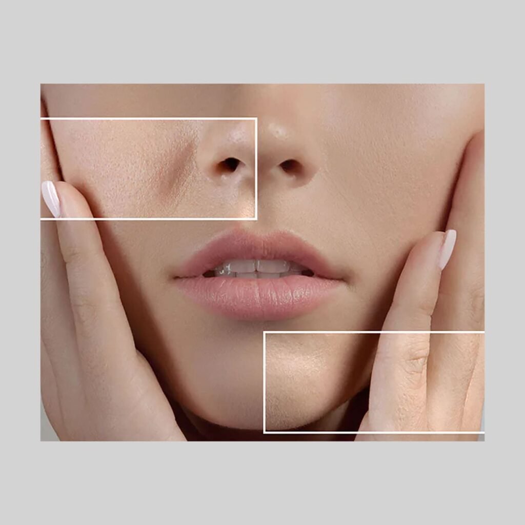 Pore Refining before after