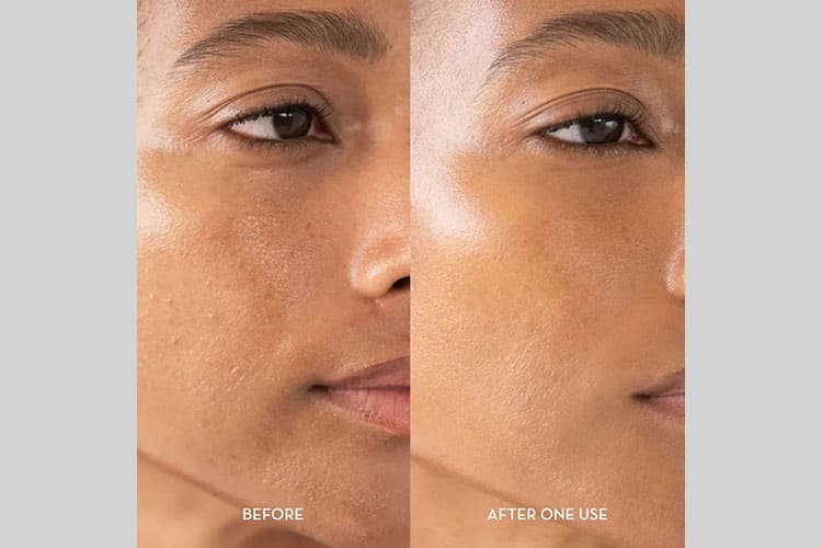 Exfoliation & Cell Renewal