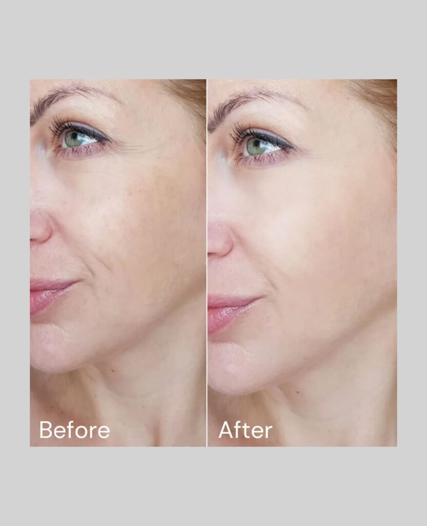Anti Oxidation before after