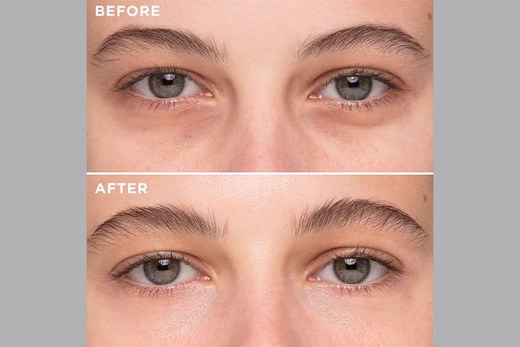 Eye De-Puffing & Fast Refresh