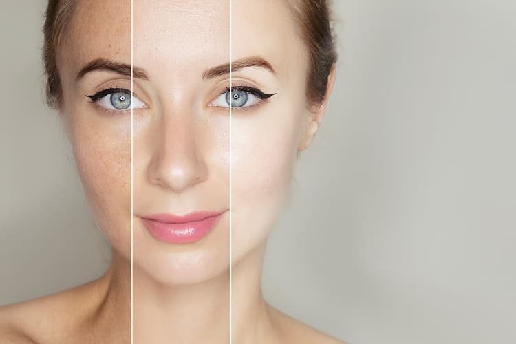 Tone Brightening & Dark-Spot Appearance