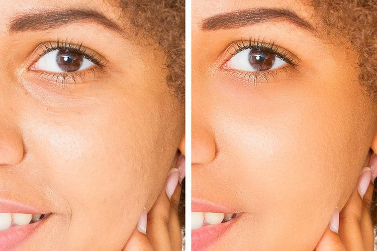 Fine Lines, Photoaging & Firmness Support